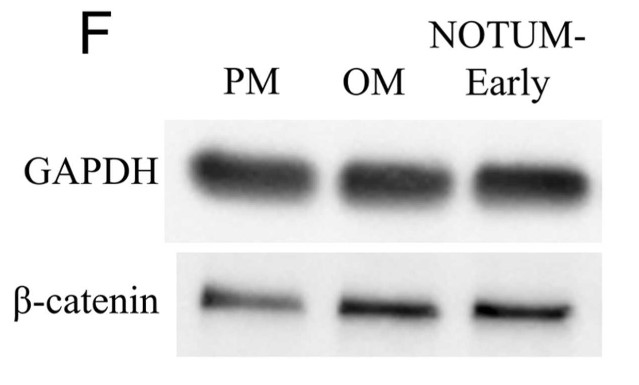 Western blot and quantitative analysis of β-catenin after adding NOTUM protein.jpg